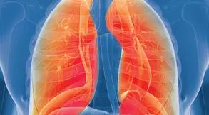 Mesothelioma Treatment in Tampa, FL